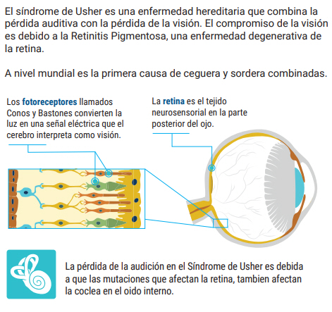 Qué es el Síndrome de USHER